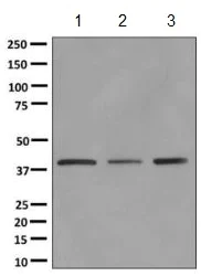 Western blot - Anti-Aspartate Aminotransferase + FABP-1 antibody [EPR12145] (AB170950)