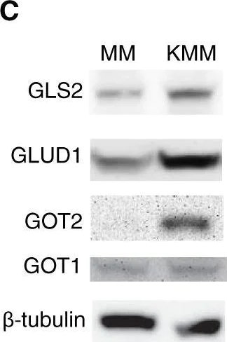 Western blot - Anti-Aspartate Aminotransferase + FABP-1 antibody [EPR12145] (AB170950)