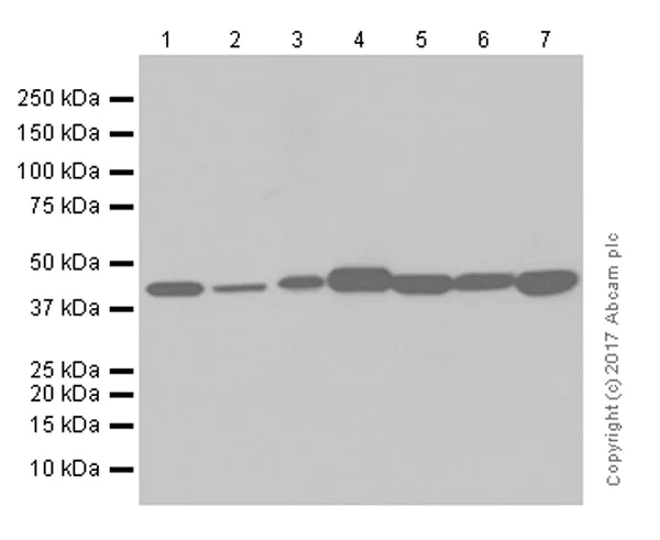 Western blot - Anti-Aspartate Aminotransferase + FABP-1 antibody [EPR12145] (AB170950)