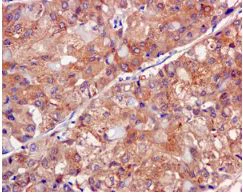 Immunohistochemistry (Formalin/PFA-fixed paraffin-embedded sections) - Anti-Aspartate Aminotransferase + FABP-1 antibody [EPR12145] - BSA and Azide free (AB232471)