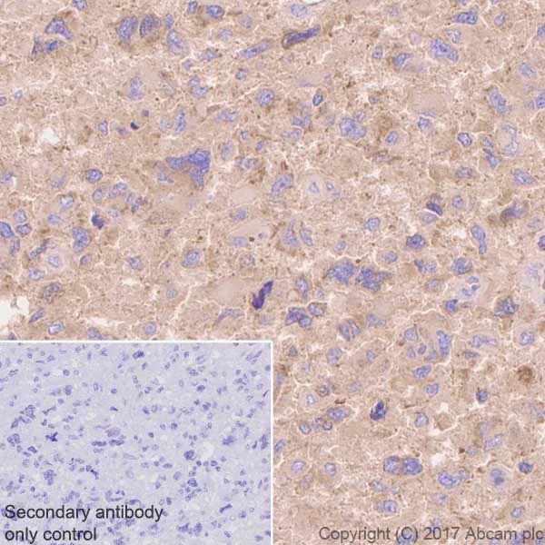 Immunohistochemistry (Formalin/PFA-fixed paraffin-embedded sections) - Anti-Aspartate Aminotransferase + FABP-1 antibody [EPR12145] - BSA and Azide free (AB232471)