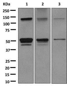 Western blot - Anti-Aspartate beta hydroxylase antibody [EPR10351] (AB172475)