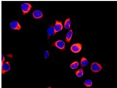 Immunocytochemistry/ Immunofluorescence - Anti-Aspartate beta hydroxylase antibody [EPR10351] - BSA and Azide free (AB249694)