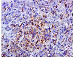 Immunohistochemistry (Formalin/PFA-fixed paraffin-embedded sections) - Anti-Aspartate beta hydroxylase antibody [EPR10351] - BSA and Azide free (AB249694)