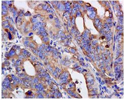 Immunohistochemistry (Formalin/PFA-fixed paraffin-embedded sections) - Anti-Aspartate beta hydroxylase antibody [EPR10351] - BSA and Azide free (AB249694)