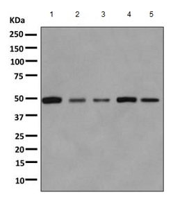Western blot - Anti-Aspartyl Aminopeptidase antibody [EPR10300] (AB155286), expandable thumbnail
