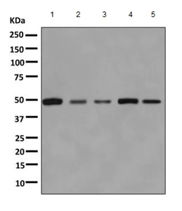 Western blot - Anti-Aspartyl Aminopeptidase antibody [EPR10300] (AB155286)