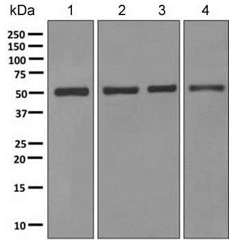 Western blot - Anti-Aspartyl Aminopeptidase antibody [EPR10301] (AB154805)