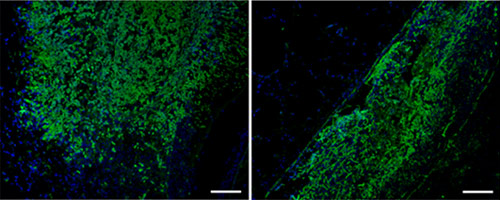 Immunohistochemistry (Frozen sections) - Anti-Aspergillus antibody (AB20419)