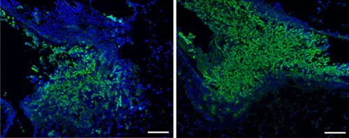 Immunohistochemistry (Frozen sections) - Anti-Aspergillus antibody (AB20419)