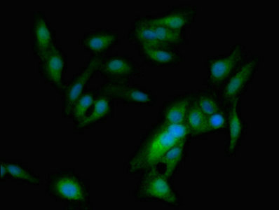Immunocytochemistry/ Immunofluorescence - Anti-ASPM antibody (AB238106), expandable thumbnail