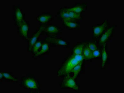 Immunocytochemistry/ Immunofluorescence - Anti-ASPM antibody (AB238106)