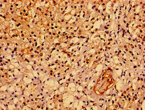 Immunohistochemistry (Formalin/PFA-fixed paraffin-embedded sections) - Anti-ASPM antibody (AB238106)