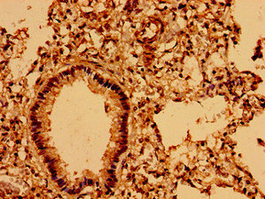 Immunohistochemistry (Formalin/PFA-fixed paraffin-embedded sections) - Anti-ASPM antibody (AB238106), expandable thumbnail