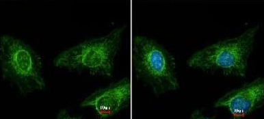 Immunocytochemistry/ Immunofluorescence - Anti-Asporin antibody (AB154404), expandable thumbnail