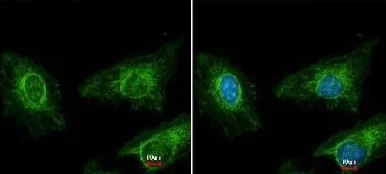 Immunocytochemistry/ Immunofluorescence - Anti-Asporin antibody (AB154404)