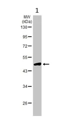 Western blot - Anti-Asporin antibody (AB154404)