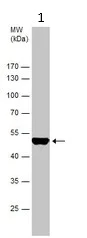 Western blot - Anti-Asporin antibody (AB154404)