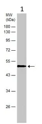 Western blot - Anti-Asporin antibody (AB154404)