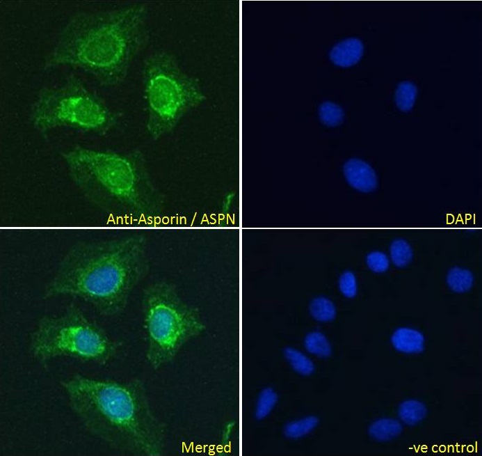 Immunocytochemistry - Anti-Asporin antibody (AB31303)