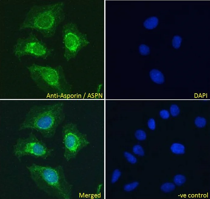 Immunocytochemistry - Anti-Asporin antibody (AB31303)