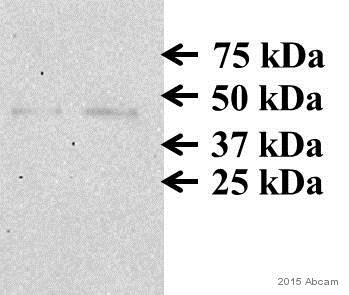 Anti-Asporin antibody (ab31303) | Abcam
