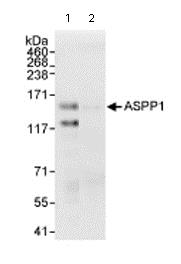 Immunoprecipitation - Anti-ASPP1 antibody (AB71163)