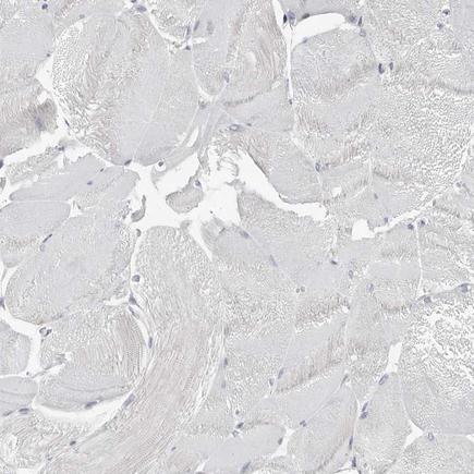 Immunohistochemistry (Formalin/PFA-fixed paraffin-embedded sections) - Anti-ASRGL1 antibody (AB150832)