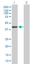 Western blot - Anti-ASRGL1 antibody (AB168992)