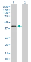 Western blot - Anti-ASRGL1 antibody (AB168992)