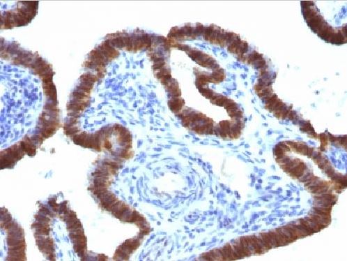 Immunohistochemistry (Formalin/PFA-fixed paraffin-embedded sections) - Anti-ASRGL1 antibody [CRASH/1289] (AB218336), expandable thumbnail