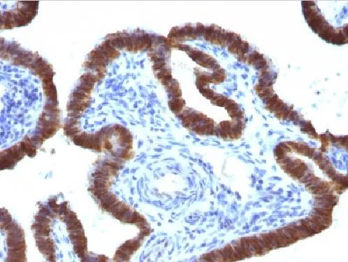 Immunohistochemistry (Formalin/PFA-fixed paraffin-embedded sections) - Anti-ASRGL1 antibody [CRASH/1289] (AB218336)