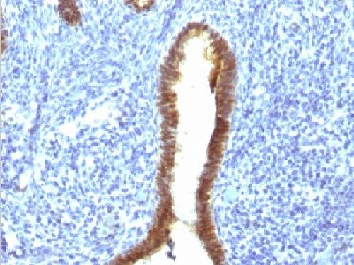 Immunohistochemistry (Formalin/PFA-fixed paraffin-embedded sections) - Anti-ASRGL1 antibody [CRASH/1289] (AB218336), expandable thumbnail