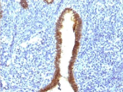 Immunohistochemistry (Formalin/PFA-fixed paraffin-embedded sections) - Anti-ASRGL1 antibody [CRASH/1289] (AB218336)