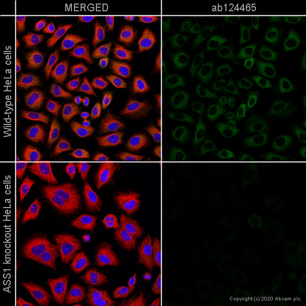 Immunocytochemistry/ Immunofluorescence - Anti-ASS1 antibody [2B10] (AB124465), expandable thumbnail