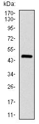 Western blot - Anti-ASS1 antibody [2B10] (ab124465), expandable thumbnail