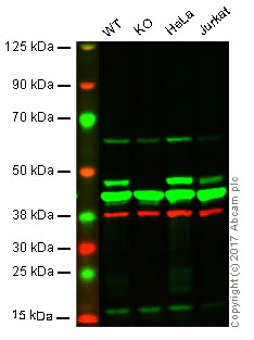 Western blot - Anti-ASS1 antibody [2B10] (AB124465)