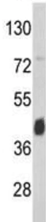Western blot - Anti-ASS1 antibody (AB191165)