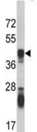 Western blot - Anti-ASS1 antibody (AB191165)