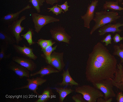 Immunocytochemistry/ Immunofluorescence - Anti-ASS1 antibody (AB77590), expandable thumbnail
