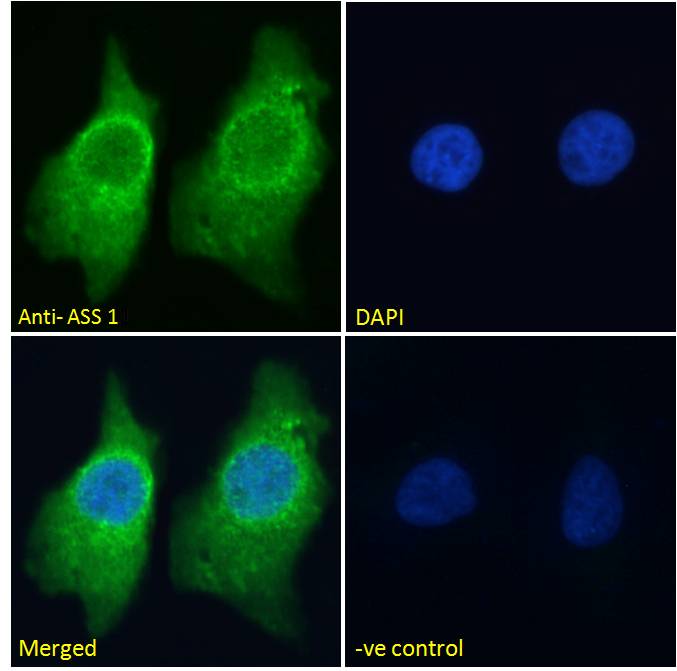 Immunocytochemistry/ Immunofluorescence - Anti-ASS1 antibody (AB77590), expandable thumbnail