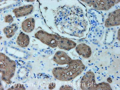 Immunohistochemistry (Formalin/PFA-fixed paraffin-embedded sections) - Anti-ASS1 antibody (ab77590), expandable thumbnail