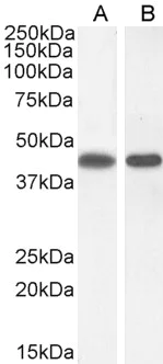 Western blot - Anti-ASS1 antibody (AB77590)