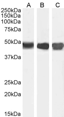 Western blot - Anti-ASS1 antibody (AB77590), expandable thumbnail