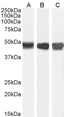 Western blot - Anti-ASS1 antibody (AB77590)
