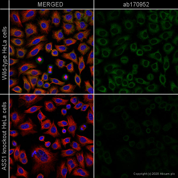 Immunocytochemistry/ Immunofluorescence - Anti-ASS1 antibody [EPR12398] (AB170952), expandable thumbnail