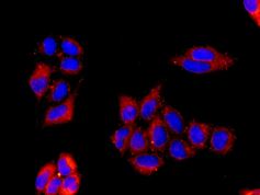 Immunocytochemistry/ Immunofluorescence - Anti-ASS1 antibody [EPR12398] (ab170952), expandable thumbnail
