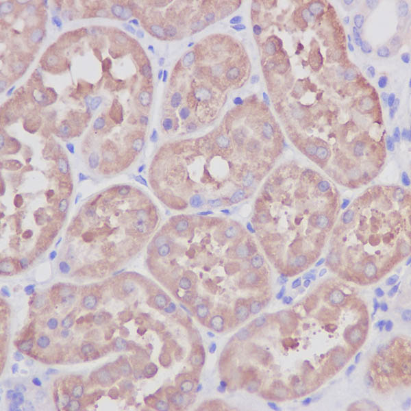 Immunohistochemistry (Formalin/PFA-fixed paraffin-embedded sections) - Anti-ASS1 antibody [EPR12398] (ab170952), expandable thumbnail