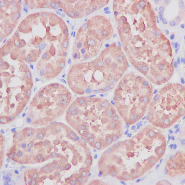 Immunohistochemistry (Formalin/PFA-fixed paraffin-embedded sections) - Anti-ASS1 antibody [EPR12398] (AB170952)
