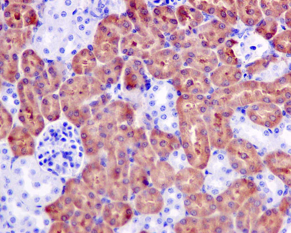 Immunohistochemistry (Formalin/PFA-fixed paraffin-embedded sections) - Anti-ASS1 antibody [EPR12398] (AB170952)